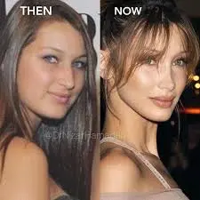 The Rise of Bella Hadid: Fashion Icon and Philanthropist