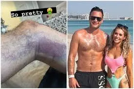 Gary Lucy: A Look into His Career and Recent Developments
