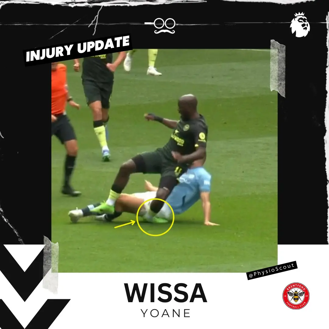 Wissa Injury: Implications and Updates