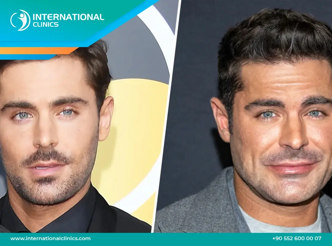 Zac Efron: From Disney Star to Hollywood Darling