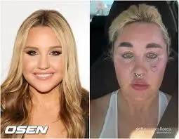Amanda Bynes: From Child Star to Recent Developments