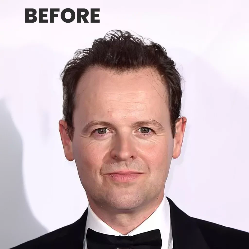 Declan Donnelly: A Journey Through Television History