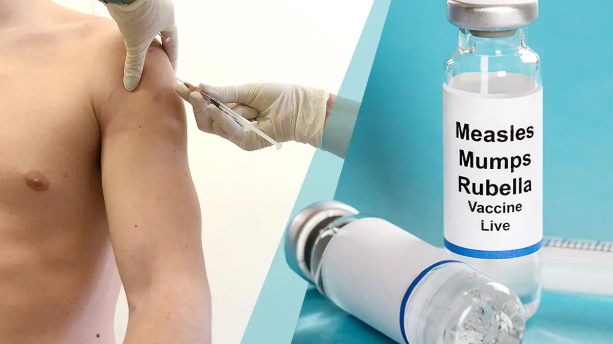 The Global Impact of Measles in 2023