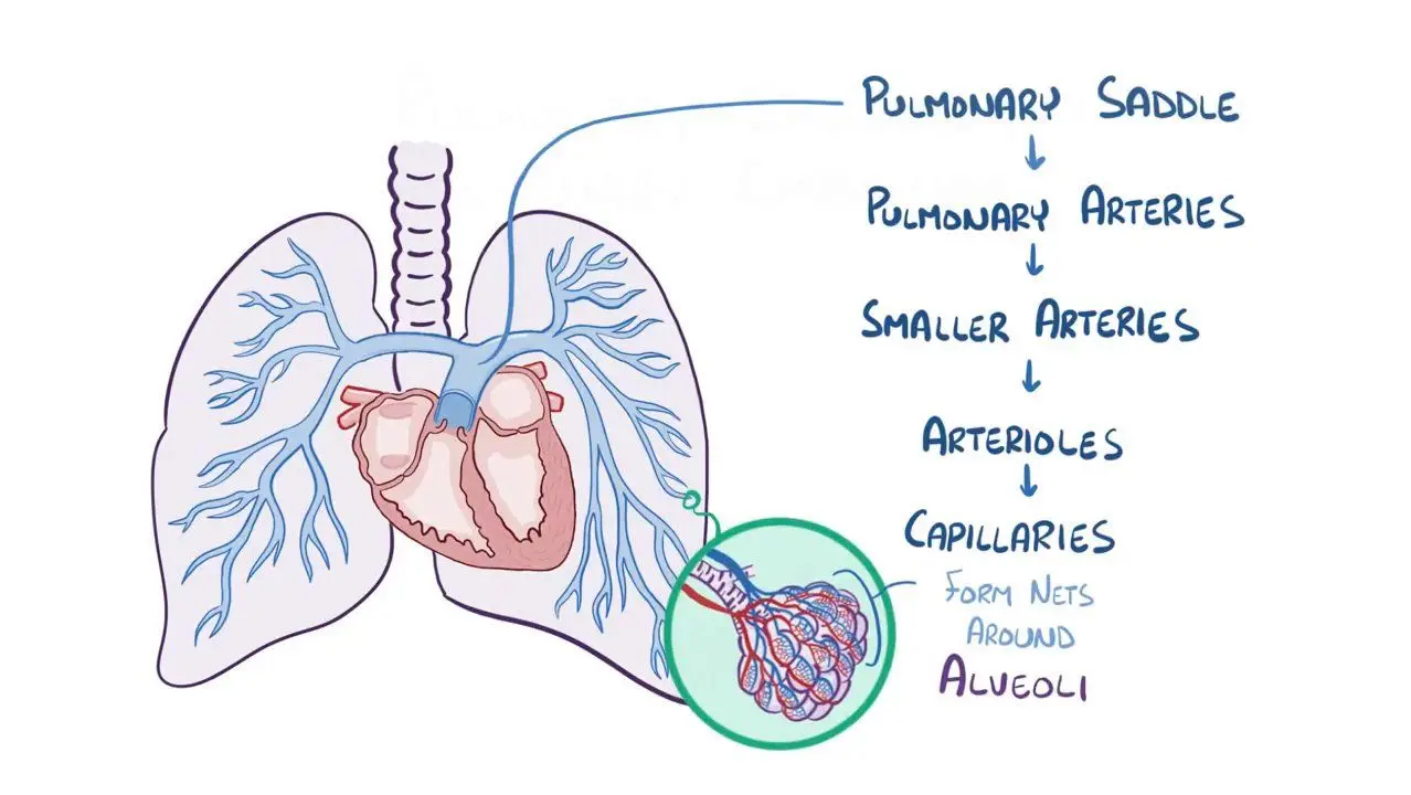 Pulmonary Embolism: A Critical Health Concern
